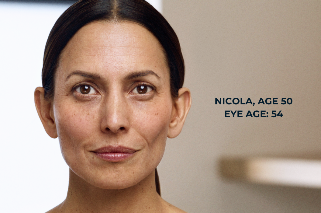 study participant Nicola is age 50 with an eye age of 54