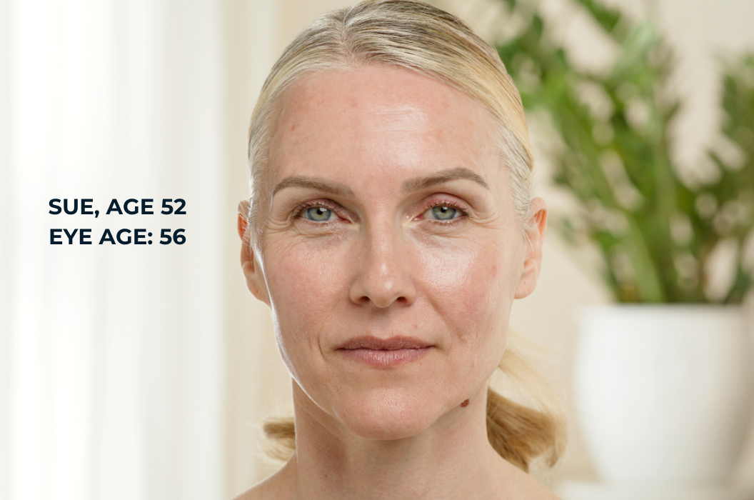 Study participant sue is 52 years old and her eye age is 56