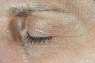 After (2 weeks) photo for dual eye cream. Shows eye and under eye of consumer