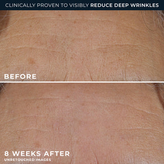 clinically proven to visibly reduce deep wrinkles
before and after 8 weeks
unretouched images