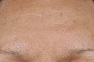 close up of persons forehead 60 minutes after applying RoC's hydration+ serum stick
