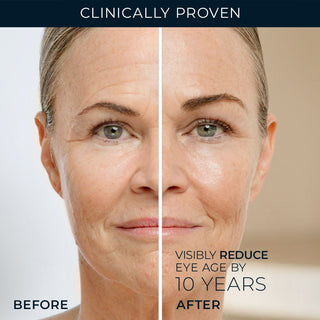 Before & After for Line Smoothing Eye Cream: Clinically Proven to visibly reduce eye age by up to -10 years