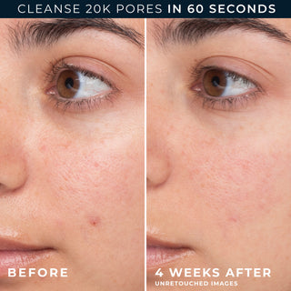 cleanse 20k pores in 60 seconds