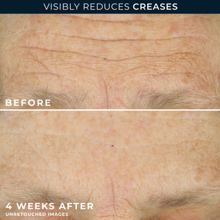 Visibly reduces creases