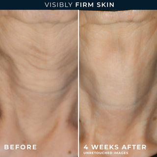 Visibly Firm Skin
