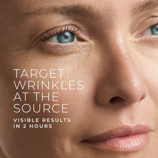 target wrinkles at the source visible results in 2 hours
