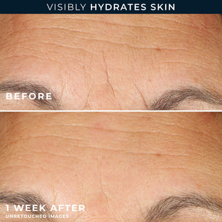 Visibly hydrates Skin
Before After