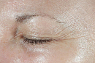 Hydration+ Moisturizer is clinically proven to deliver results. There are unretouched before and after images shown. The before image shows deep forehead wrinkles and crows feet around the eyes.