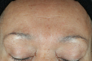 Hydration+ Serum is clinically proven to deliver results. There are unretouched before and after images shown. The after 4 weeks images shows drastically reduced foreheads lines.