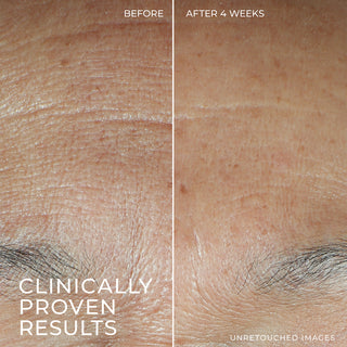 Pictured is the clinically proven result of the product. On the right is the before image and the left shows the results after 4 weeks