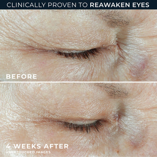 Clinically proven to reawaken eyes
before 
4 weeks after