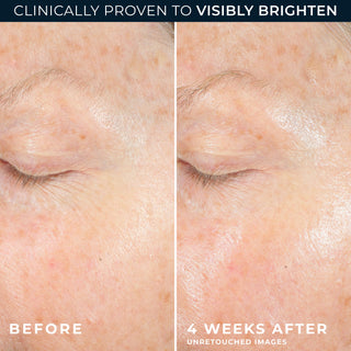 clinically proven to visibly brighten 
before and after 4 weeks