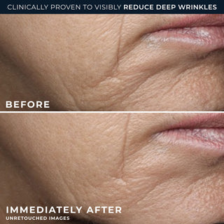 clinically proven to visibly reduce deep wrinkles