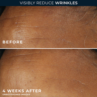 visibly reduce wrinkles
before and after 4 weeks