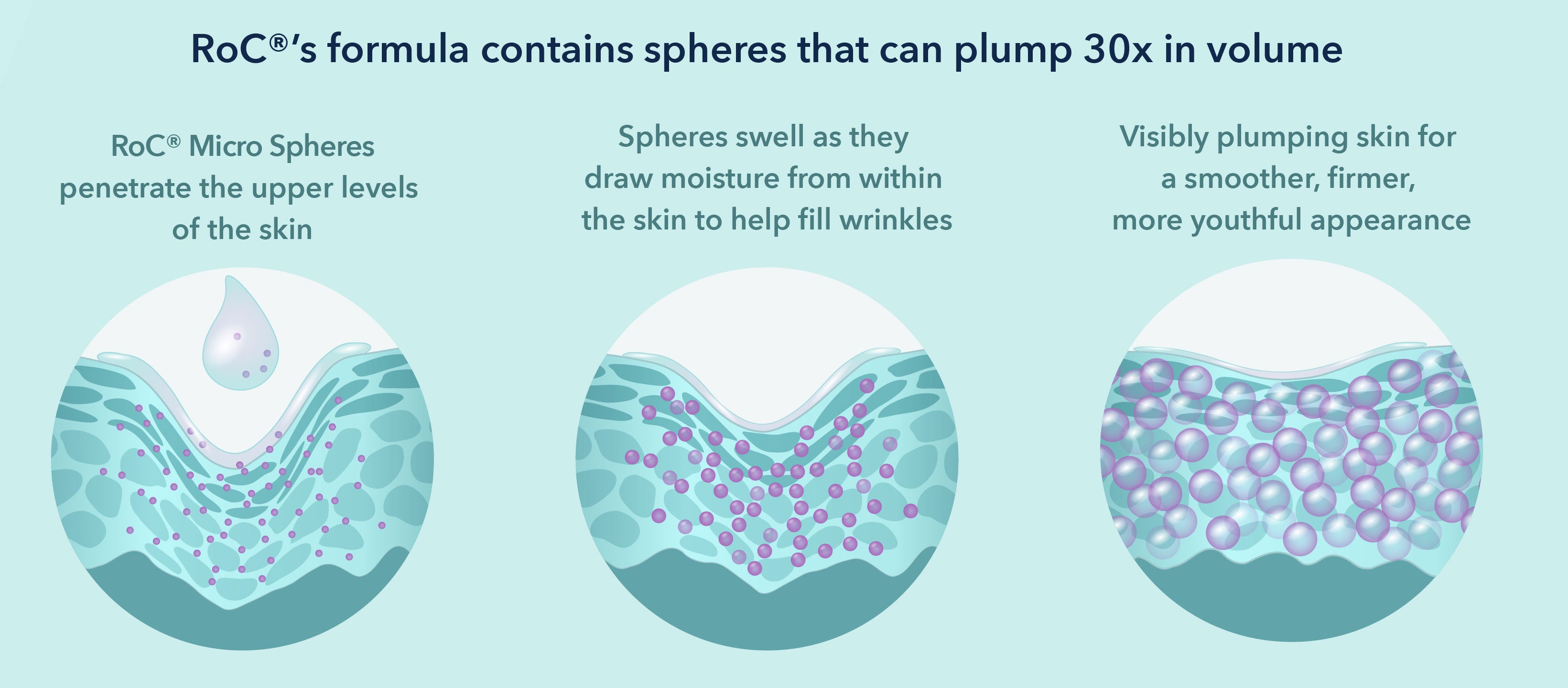 RoC®'s formula contains spheres that can plump 30x in volume. RoC® Micro Spheres penetrate the upper levels of the skin. Spheres swell as they draw moisture from within the skin to help fill wrinkles. Visibly plumping skin for a smoother, firmer, more youthful appearance.