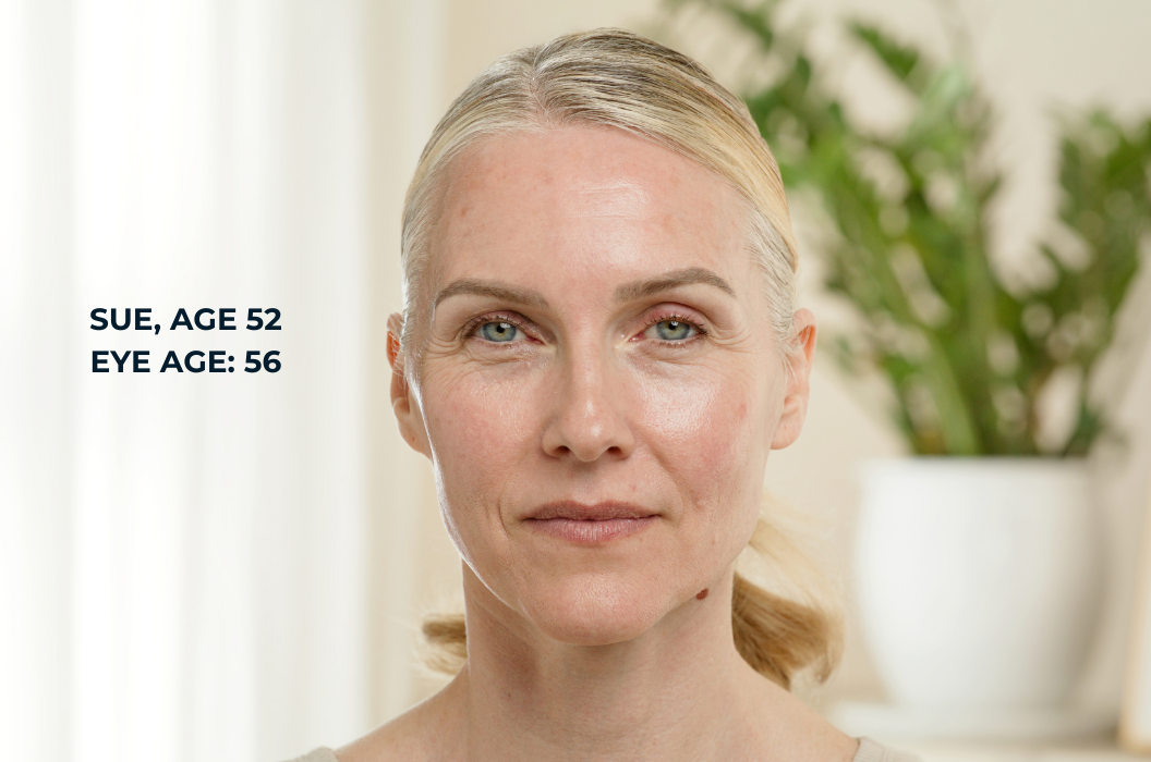 Sue, age 52
eye age: 56