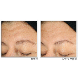 MULTI CORREXION® Revive + Glow Gel Cleanser before and after image showing customer eye and forehead area brighter and smoother after 2 weeks of use
