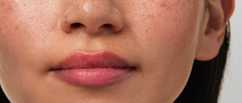 An Innovative and Non-Invasive Lip Treatment for Immediate and Lasting Improvements in Lip Hydration and Volume