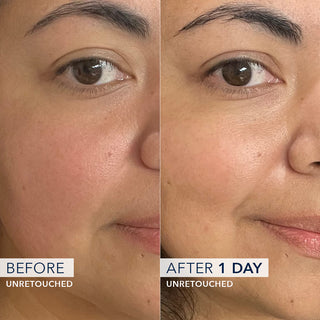 Unretouched Before+ After images showing a Barrier Renew clinical study participants cheek showing a reduction of redness and healthy glow after just one day of use. 