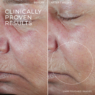Image of DERM CORREXION® Firming Serum Stick clinical study participants cheek showing increased firmness after 1 week of use. 