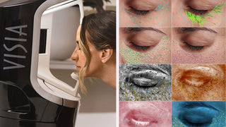 Collage of a VISIA machine, a woman's face, and close-up images of skin texture.