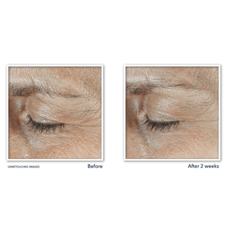 Before and After image for Derm Correxion Dual Eye Cream. Image shows decrease in visibly lines around eye orbital bone