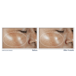 Before & After images of clinical participant showing brightened appearance of skin after 4 weeks of  using MULTI CORREXION® Revive + Glow Moisturizer SPF 30.