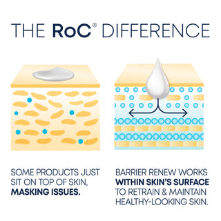 Inforgraphic of The RoC Difference. Image shows skin layer comparison of other products vs. RoC Barrier Renew. Some products just sit on top of skin, masking issues.. Barrier Renew works within skin's surface to retrain + maintain healthy-looking skin.