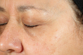 After (8 weeks) photo for revive + glow daily serum. Shows eye and under eye of consumer