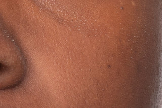Image of participants cheek before use of AM Moisturizer