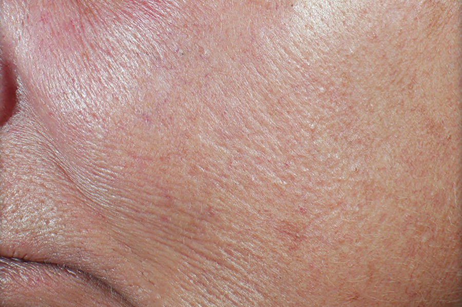 DERM CORREXION® Firming Serum Stick RoC® Skincare