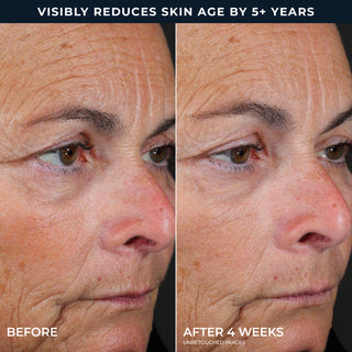 Visibly reduces skin age by 5+ years
Before 
After 4 weeks 
Unretouched Images