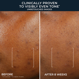 Before-and-after skin tone comparison showing textured brown skin labeled 'BEFORE' and 'AFTER 8 WEEKS' under the claim 'CLINICALLY PROVEN TO VISIBLY EVEN TONE UNRETouched IMAGES'.