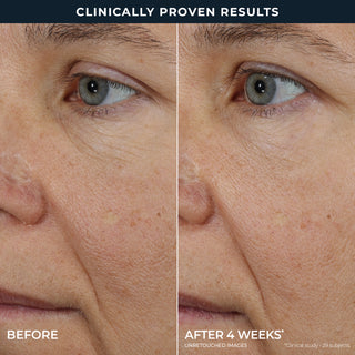 Clinically proven results of a before and after comparison of a person's eye area before and after 4 weeks* 
Unretouched images 
*Clinical study - 29 subjects