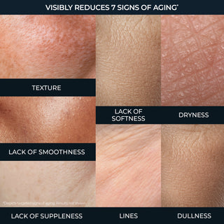 Collage of skin texture with labels for aging signs reduction.
Texture, Lack of softness, dryness, lack of smoothness, lack on suppleness, lines, dullness
*Depicts targeted signs of aging. results not show.
