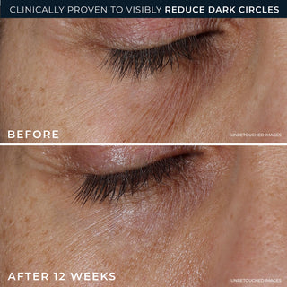 clinically proven to visibly reduce dark circles
before and after 12 weeks
unretouched images