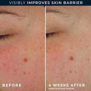 visibly improves skin barrier