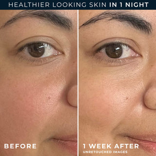healthier looking skin in 1 night