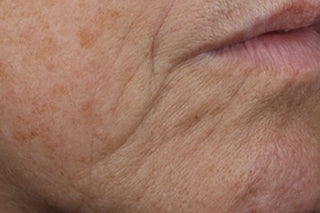 Consumer side of mouth after 4 weeks of use