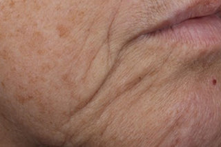 Consumer side of mouth before