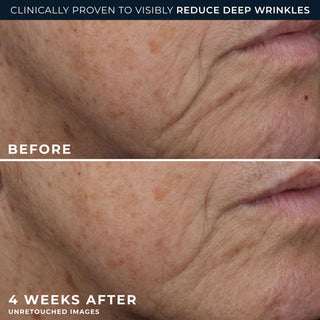 clinically proven to visibly reduce deep wrinkles