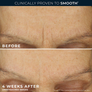 Clinically proven to smooth*
before and after 4 weeks
shown by unretouched images
*based on line smoothing max hydration cream. Results may vary.