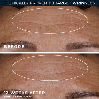 RETINOL CORREXION® Deep Wrinkle Night Cream