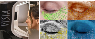 image of consumer using visia machine with visia results