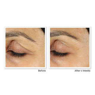 RETINOL CORREXION® Line Smoothing Eye Cream Before & After image of customer eye area showing reduced appearance of fine lines after 4 weeks of use.
