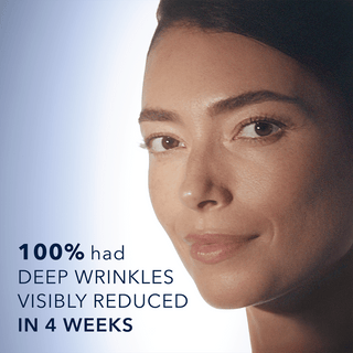 Image of model smiling. 100% had deep wrinkles visibly reduced in 4 weeks.