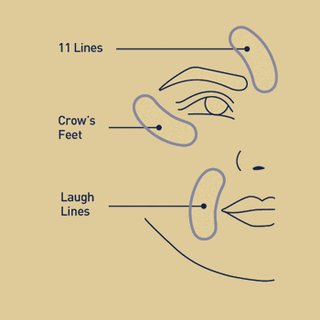 Infographic showing where RETINOL CORREXION® Deep Wrinkle Targeted Patches can be applied on face - 11 lines, crow's feet, laugh lines 